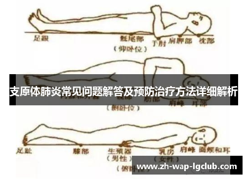 支原体肺炎常见问题解答及预防治疗方法详细解析 支原体肺炎常见问题解答及预防治疗方法详细解析